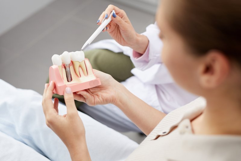 A high angle of a dental implant model 